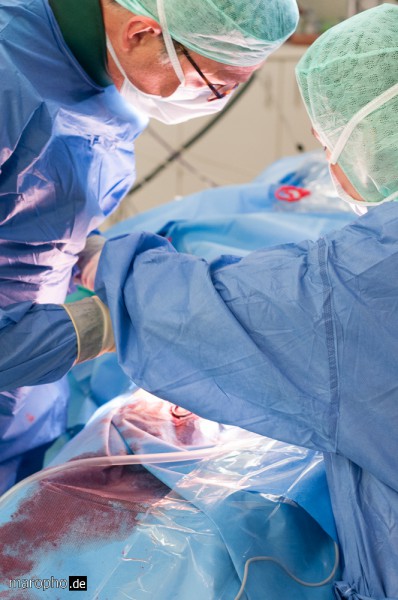 Beendigung des erfolgreichen Hybrideingriffs durch gefäßchirurgischen Verschluss der Leistenarterie durch Chefarzt Dr. Beyer und Oberärztin Dr. Weber